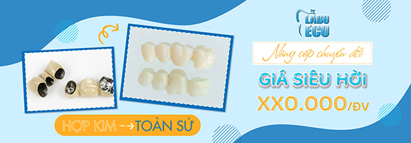 Nâng cấp chuyển đổi hợp kim sang toàn sứ giá siêu hời